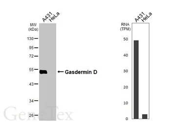 Anti-Gasdermin D antibody [N1N3] used in Western Blot (WB). GTX116840