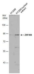 Anti-ZNF408 antibody used in Western Blot (WB). GTX116843