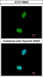 Anti-ZNF408 antibody used in Immunocytochemistry/ Immunofluorescence (ICC/IF). GTX116843