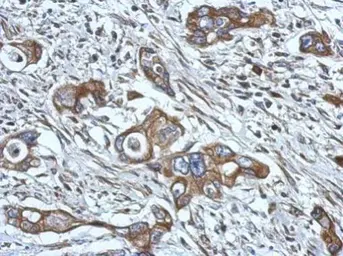 Anti-HPS6 antibody [N2C1], Internal used in IHC (Paraffin sections) (IHC-P). GTX116845