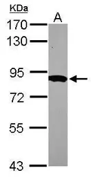 Anti-HPS6 antibody [N2C1], Internal used in Western Blot (WB). GTX116845