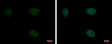 Anti-Pygopus 2 antibody used in Immunocytochemistry/ Immunofluorescence (ICC/IF). GTX116847