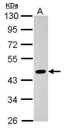 Anti-Pygopus 2 antibody used in Western Blot (WB). GTX116847