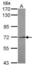 Anti-NEK11 antibody [N3C2], Internal used in Western Blot (WB). GTX116851