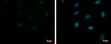 Anti-ZNF556 antibody used in Immunocytochemistry/ Immunofluorescence (ICC/IF). GTX116867