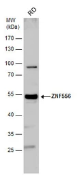 Anti-ZNF556 antibody used in Western Blot (WB). GTX116867