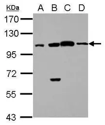 Anti-FAAP100 antibody [C2C3], C-term used in Western Blot (WB). GTX116871