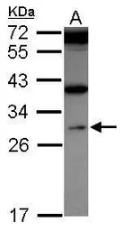 Anti-WDR61 antibody used in Western Blot (WB). GTX116881