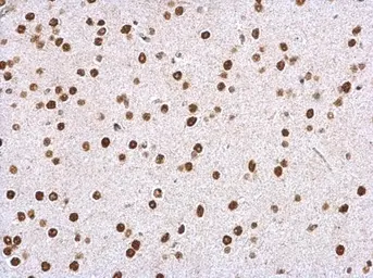 Anti-WDR61 antibody used in IHC (Paraffin sections) (IHC-P). GTX116882