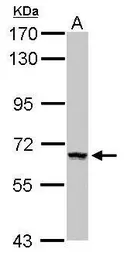 Anti-ZNF34 antibody [N1C1] used in Western Blot (WB). GTX116886