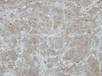 Anti-ITM2C antibody used in IHC (Paraffin sections) (IHC-P). GTX116904
