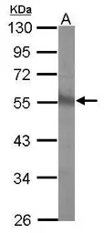 Anti-CHST9 antibody [N3C3] used in Western Blot (WB). GTX116917