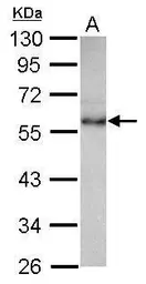 Anti-CHST9 antibody [N3C3] used in Western Blot (WB). GTX116917