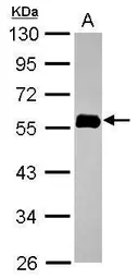 Anti-NORE1 antibody used in Western Blot (WB). GTX116921