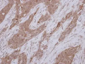 Anti-Tektin 1 antibody [N1C2] used in IHC (Paraffin sections) (IHC-P). GTX116922