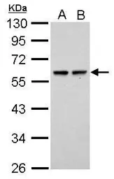 Anti-SESN2 antibody used in Western Blot (WB). GTX116925