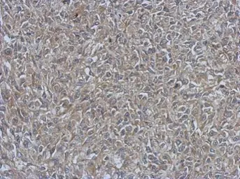 Anti-URP2 antibody used in IHC (Paraffin sections) (IHC-P). GTX116928