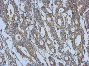 Anti-URP2 antibody used in IHC (Paraffin sections) (IHC-P). GTX116928