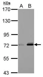 Anti-URP2 antibody used in Western Blot (WB). GTX116928