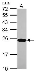 Anti-C1orf57 antibody [N1C3] used in Western Blot (WB). GTX116960