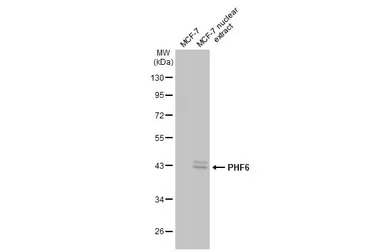 Anti-PHF6 antibody [N2C2], Internal used in Western Blot (WB). GTX116966