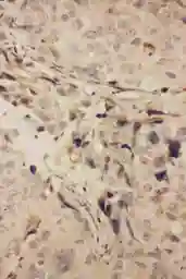 Anti-RANK antibody used in IHC (Paraffin sections) (IHC-P). GTX11697