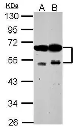 Anti-ZFYVE19 antibody used in Western Blot (WB). GTX117000