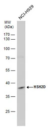 Anti-HSH2D antibody used in Western Blot (WB). GTX117004