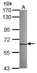 Anti-CML66 antibody [N1N3] used in Western Blot (WB). GTX117006
