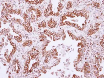 Anti-CML66 antibody used in IHC (Paraffin sections) (IHC-P). GTX117007