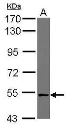 Anti-CML66 antibody used in Western Blot (WB). GTX117007