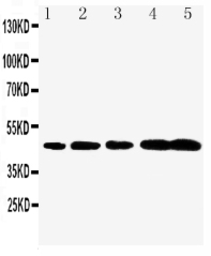 Anti-Caspase 1 p20 subunit antibody used in Western Blot (WB). GTX11701