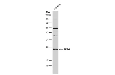 Anti-RERG antibody used in Western Blot (WB). GTX117011