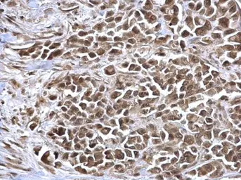 Anti-NAV2 antibody used in IHC (Paraffin sections) (IHC-P). GTX117023