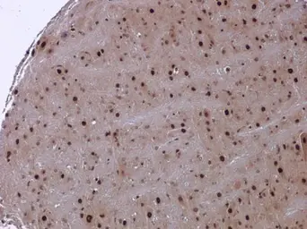 Anti-NAV2 antibody used in IHC (Paraffin sections) (IHC-P). GTX117023