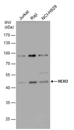 Anti-ERI1 antibody used in Western Blot (WB). GTX117034