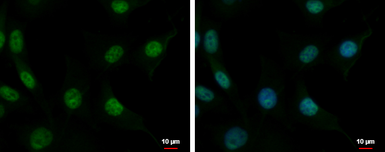 Anti-CUGBP2 antibody used in Immunocytochemistry/ Immunofluorescence (ICC/IF). GTX117035