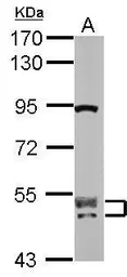 Anti-CUGBP2 antibody used in Western Blot (WB). GTX117035