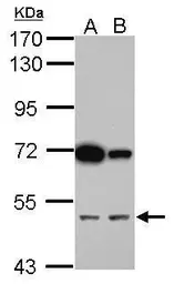 Anti-CUGBP2 antibody used in Western Blot (WB). GTX117035