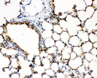 Anti-Surfactant Protein A antibody used in IHC (Paraffin sections) (IHC-P). GTX11706