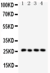 Anti-Surfactant Protein A antibody used in Western Blot (WB). GTX11706