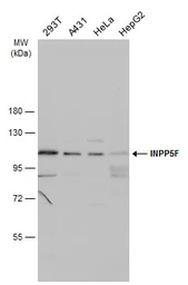 Anti-INPP5F antibody used in Western Blot (WB). GTX117067