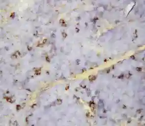 Anti-CXCL16 antibody used in IHC (Paraffin sections) (IHC-P). GTX11708