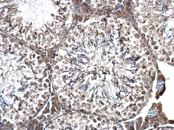 Anti-PRPF31 antibody used in IHC (Paraffin sections) (IHC-P). GTX117081