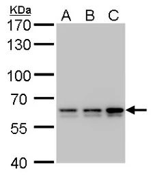 Anti-PRPF31 antibody used in Western Blot (WB). GTX117081