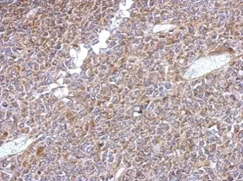 Anti-KLHL1 antibody used in IHC (Paraffin sections) (IHC-P). GTX117085