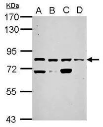 Anti-KLHL1 antibody used in Western Blot (WB). GTX117085