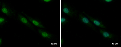 Anti-ZFP82 antibody used in Immunocytochemistry/ Immunofluorescence (ICC/IF). GTX117099