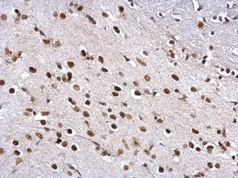 Anti-ZFP82 antibody used in IHC (Paraffin sections) (IHC-P). GTX117099