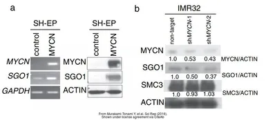 Anti-SGOL1 antibody used in Western Blot (WB). GTX117103